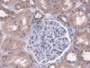 DAB staining on IHC-P; Samples: Human Kidney Tissue; Primary Ab: 20µg/ml Rabbit Anti-Human PC Antibody Second Ab: 2µg/mL HRP-Linked Caprine Anti-Rabbit IgG Polyclonal Antibody