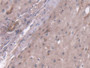 DAB staining on IHC-P; Samples: Human Liver Tissue; Primary Ab: 20µg/ml Rabbit Anti-Human PC Antibody Second Ab: 2µg/mL HRP-Linked Caprine Anti-Rabbit IgG Polyclonal Antibody