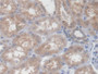 DAB staining on IHC-P; Samples: Human Kidney Tissue;  Primary Ab: 20µg/ml Rabbit Anti-Human PCYOX1 A