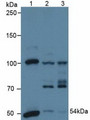 Western Blot; Sample: Lane1: Human A431 Cells; Lane2: Human Hela Cells; Lane3: Porcine Heart Tissue.