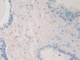 DAB staining on IHC-P; Samples: Human Prostate Gland Tissue.
