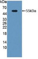 Western Blot; Sample: Recombinant PGP, Mouse.