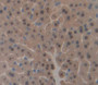 Used in DAB staining on fromalin fixed paraffin- embedded liver tissue