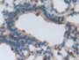 DAB staining on IHC-P; Samples: Mouse Lung Tissue; Primary Ab: 20µg/ml Rabbit Anti-Mouse PLS3 Antibody Second Ab: 2µg/mL HRP-Linked Caprine Anti-Rabbit IgG Polyclonal Antibody