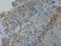 DAB staining on IHC-P; Samples: Human Stomach Tissue; Primary Ab: 20µg/ml Rabbit Anti-Human PLS3 Antibody Second Ab: 2µg/mL HRP-Linked Caprine Anti-Rabbit IgG Polyclonal Antibody