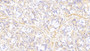 DAB staining on IHC-P; Samples: Human Stomach Tissue; Primary Ab: 20μg/ml Rabbit Anti-Human PLS3 Antibody Second Ab: 2µg/mL HRP-Linked Caprine Anti-Rabbit IgG Polyclonal Antibody