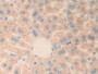DAB staining on fromalin fixed paraffin- embedded Kidney tissue)