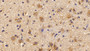 Paraneoplastic Antigen Ma2 (Pnma2) Polyclonal Antibody, Cat#CAU21988