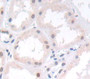 Paraneoplastic Antigen Ma2 (Pnma2) Polyclonal Antibody, Cat#CAU21989