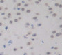 Peroxisome Proliferator Activated Receptor Gamma Coactivator 1 Alpha (Ppargc1A) Polyclonal Antibody, Cat#CAU21997