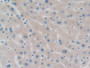 DAB staining on IHC-P; Samples: Human Liver Tissue;  Primary Ab: 10µg/ml Rabbit Anti-Human PPM1A Ant