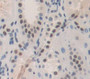 Preferentially Expressed Antigen In Melanoma (Prame) Polyclonal Antibody, Cat#CAU22003