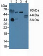 Western Blot; Lane1: Human Blood Cells; Lane2: Human 293T Cells; Lane3: Human Jurkat Cells.