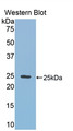 Western Blot; Sample: Recombinant protein.