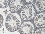 DAB staining on IHC-P; Samples: Mouse Testis Tissue;  Primary Ab: 20µg/ml Rabbit Anti-Mouse RCN2 Ant