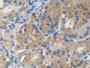 DAB staining on IHC-P; Samples: Human Stomach Tissue; Primary Ab: 20µg/ml Rabbit Anti-Human SCARA5 Antibody Second Ab: 2µg/mL HRP-Linked Caprine Anti-Rabbit IgG Polyclonal Antibody