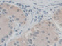 DAB staining on IHC-P; Samples: Human Stomach Tissue; Primary Ab: 10µg/ml Rabbit Anti-Human SGSH Antibody Second Ab: 2µg/mL HRP-Linked Caprine Anti-Rabbit IgG Polyclonal Antibody