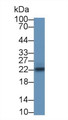 Western Blot; Sample: Rat Liver lysate; Primary Ab: 1µg/ml Rabbit Anti-Rat SOCS2 Antibody Second Ab: 0.2µg/mL HRP-Linked Caprine Anti-Rabbit IgG Polyclonal Antibody