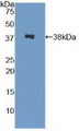 Western Blot; Sample: Recombinant SPINK1, Human.