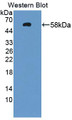 Western Blot; Sample: Recombinant protein.