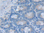 DAB staining on IHC-P; Samples: Rat Small intestine Tissue; Primary Ab: 30µg/ml Rabbit Anti-Rat STAP1 Antibody Second Ab: 2µg/mL HRP-Linked Caprine Anti-Rabbit IgG Polyclonal Antibody