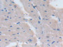 DAB staining on fromalin fixed paraffin- embedded Kidney tissue)