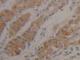 DAB staining on IHC-P; Samples: Human Stomach Tissue; Primary Ab: 20µg/ml Rabbit Anti-Human SUOX Antibody Second Ab: 2µg/mL HRP-Linked Caprine Anti-Rabbit IgG Polyclonal Antibody