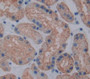 Transcription Factor A, Mitochondrial (Tfam) Polyclonal Antibody, Cat#CAU22073