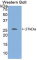 Western Blot; Sample: Recombinant protein.