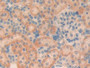 DAB staining on IHC-P; Samples: Rat Kidney Tissue; Primary Ab: 10µg/ml Rabbit Anti-Rat TGFb1I1 Antibody Second Ab: 2µg/mL HRP-Linked Caprine Anti-Rabbit IgG Polyclonal Antibody