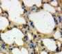 Used in DAB staining on fromalin fixed paraffin-embedded Lung tissue