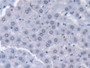 DAB staining on IHC-P; Samples: Rat Liver Tissue; Primary Ab: 10µg/ml Rabbit Anti-Rat TKT Antibody Second Ab: 2µg/mL HRP-Linked Caprine Anti-Rabbit IgG Polyclonal Antibody
