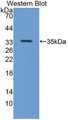 Western Blot; Sample: Recombinant protein.