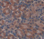 Thyroid Hormone Receptor Interactor 6 (Trip6) Polyclonal Antibody, Cat#CAU22088