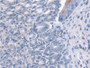 DAB staining on IHC-P; Samples: Mouse Esophagus Tissue; Primary Ab: 20µg/ml Rabbit Anti-Mouse GLRX Antibody Second Ab: 2µg/mL HRP-Linked Caprine Anti-Rabbit IgG Polyclonal Antibody