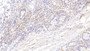 DAB staining on IHC-P; Samples: Human Small intestine Tissue; Primary Ab: 20μg/ml Rabbit Anti-Human GLRX3 Antibody Second Ab: 2µg/mL HRP-Linked Caprine Anti-Rabbit IgG Polyclonal Antibody