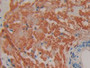 DAB staining on IHC-P; Samples: Human Prostate Tissue)