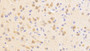 DAB staining on fromalin fixed paraffin-embedded Brain tissue)