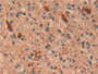 DAB staining on IHC-P; Samples: Human Glioma Tissue; Primary Ab: 10µg/ml Rabbit Anti-Human UCHL1 Antibody Second Ab: 2µg/mL HRP-Linked Caprine Anti-Rabbit IgG Polyclonal Antibody