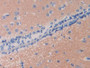 DAB staining on IHC-P; Samples: Mouse Cerebrum Tissue)