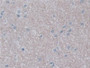 DAB staining on IHC-P; Samples: Human Cerebrum Tissue; Primary Ab: 20µg/ml Rabbit Anti-Human UNG Antibody Second Ab: 2µg/mL HRP-Linked Caprine Anti-Rabbit IgG Polyclonal Antibody