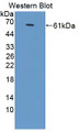 Western Blot; Sample: Recombinant protein.