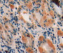 DAB staining on fromalin fixed paraffin-embedded stomach tissue)