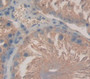 Wnt1 Inducible Signaling Pathway Protein 2 (Wisp2) Polyclonal Antibody, Cat#CAU22137