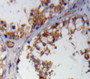 DAB staining on fromalin fixed paraffin-embedded testis tissue)