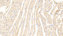 DAB staining on IHC-P; Samples: Mouse Cardiac Muscle Tissue;  Primary Ab: 20μg/ml Rabbit Anti-Mouse ANKRD1 Antibody Second Ab: 2µg/mL HRP-Linked Caprine Anti-Rabbit IgG Polyclonal Antibody 