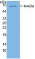 Western Blot; Sample: Recombinant PI4Ka, Human.