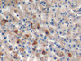 DAB staining on IHC-P; Samples: Human Liver Tissue;  Primary Ab: 10µg/ml Rabbit Anti-Human GNMT Anti