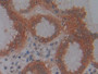 DAB staining on IHC-P; Samples: Human Stomach Tissue; Primary Ab: 10µg/ml Rabbit Anti-Human KDM4A Antibody Second Ab: 2µg/mL HRP-Linked Caprine Anti-Rabbit IgG Polyclonal Antibody