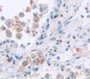 Transcobalamin Ii, Macrocytic Anemia (Tcn2) Polyclonal Antibody, Cat#CAU22157